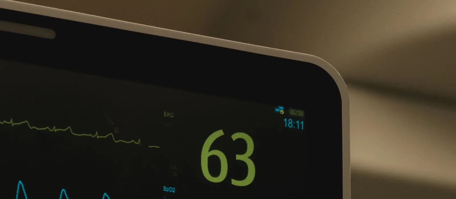 Bedside patient monitor screen showing an EKG waveform and heart rate reading